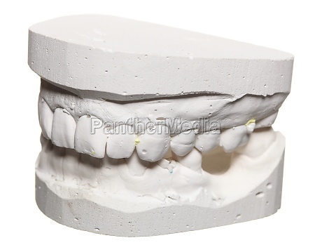 modelo de yeso dental molde de dientes en yeso - Stockphoto #11767875 |  Agencia de stock PantherMedia